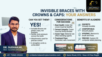 Invisible-Braces